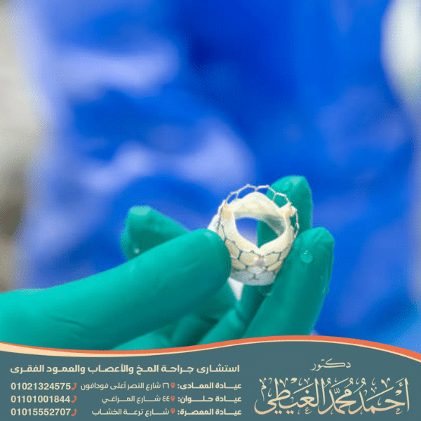 عملية زرع صمام في الدماغ