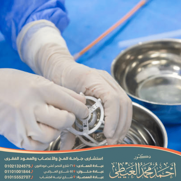 عملية زرع صمام في الدماغ