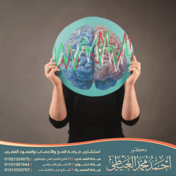 هل الصرع البؤري خطير