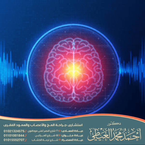 هل الصرع البؤري خطير