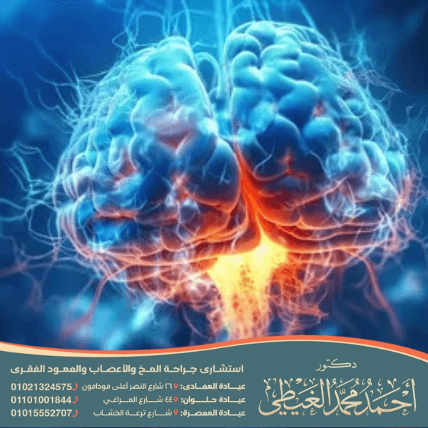 هل الصرع البؤري خطير