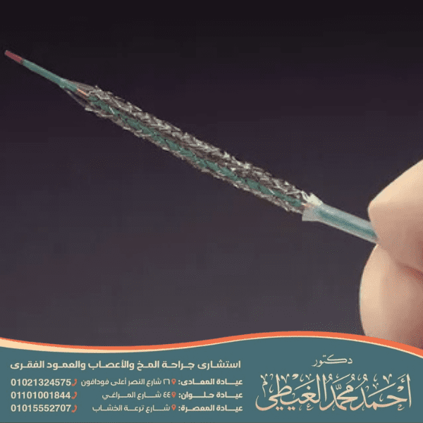 هل تركيب دعامة دوائية يعود المريض لحياته الطبيعية