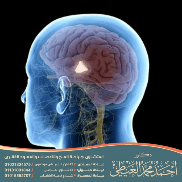 هل يمكن الشفاء من الصرع الجزئي