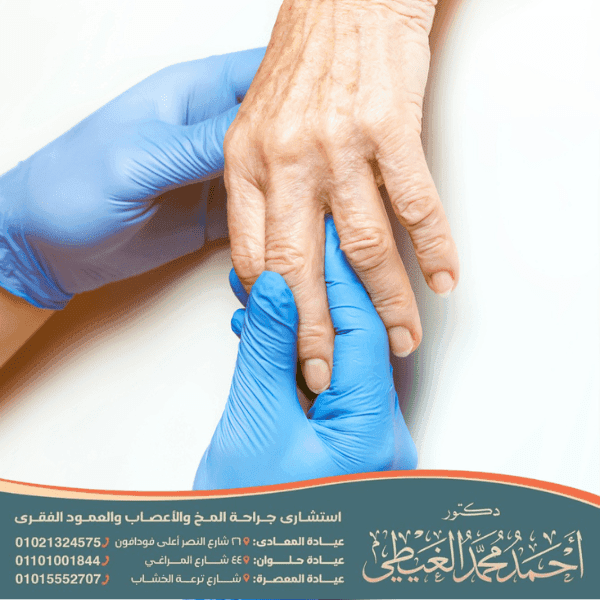 تكلفة عملية الشلل الرعاش في مصر