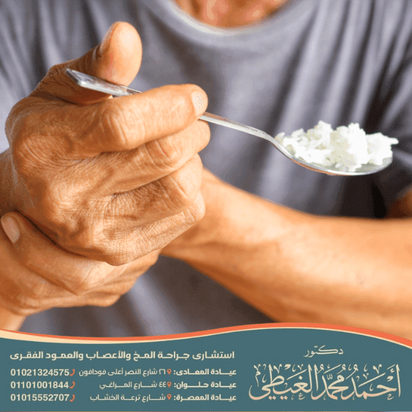 علاج مجرب للشلل الرعاش