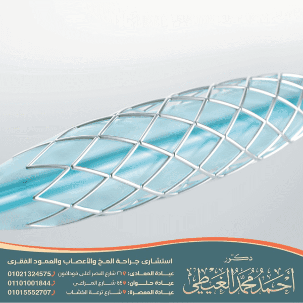 هل عملية قسطرة الدماغ خطيرة