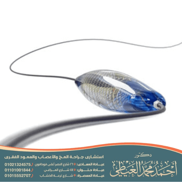 هل عملية قسطرة الدماغ خطيرة