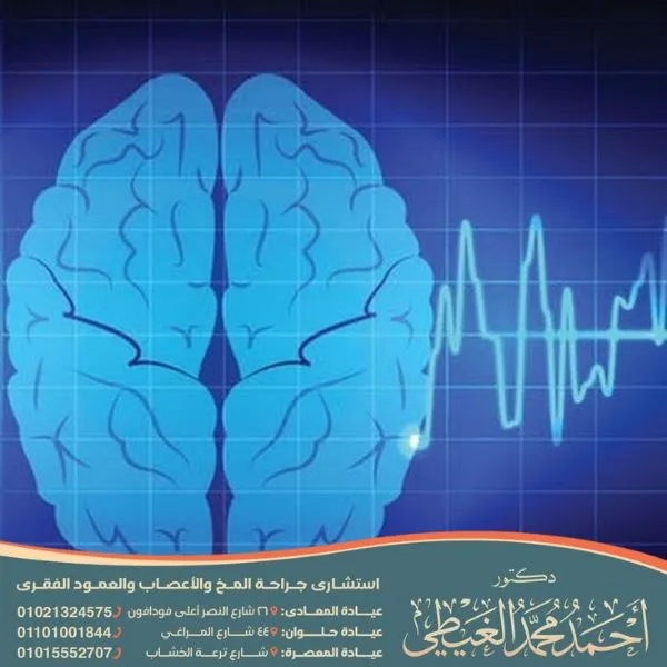 نوبات الصرع الكبرى