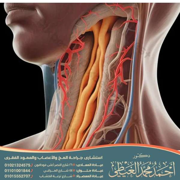 هل عملية الشريان السباتي خطيرة