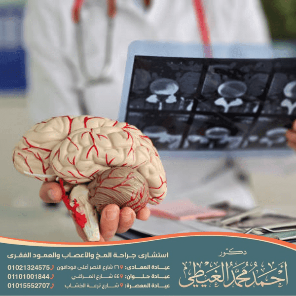 جراحة مرض الصرع