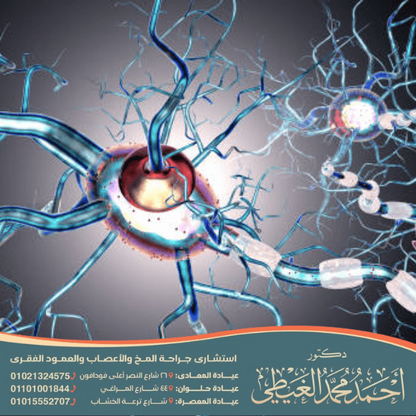 جراحة مرض الصرع