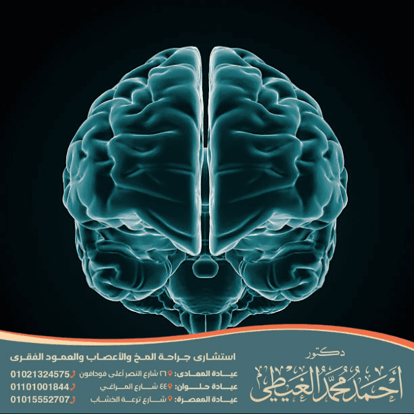 علاج الجسم الثفني في الدماغ