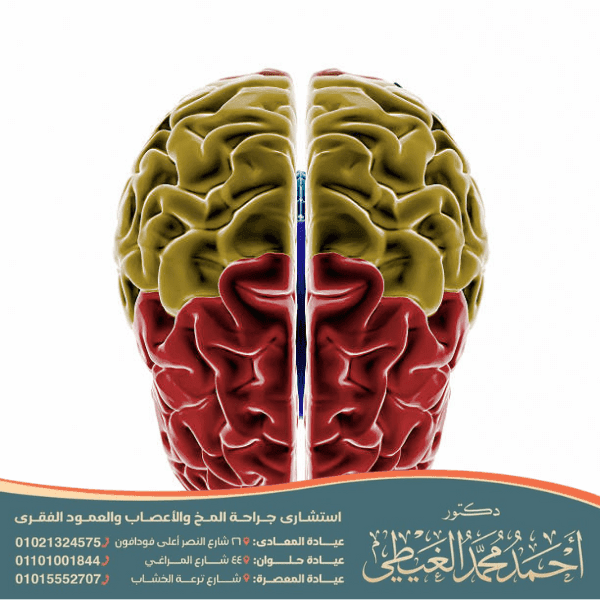 علاج الجسم الثفني في الدماغ
