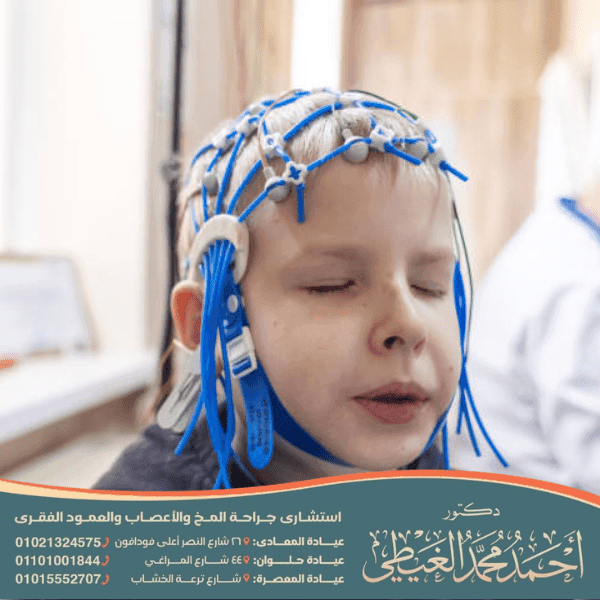 علاج الصرع أثناء النوم