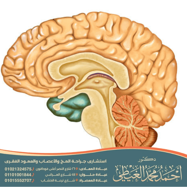 غياب الجسم الثفني عند الأطفال