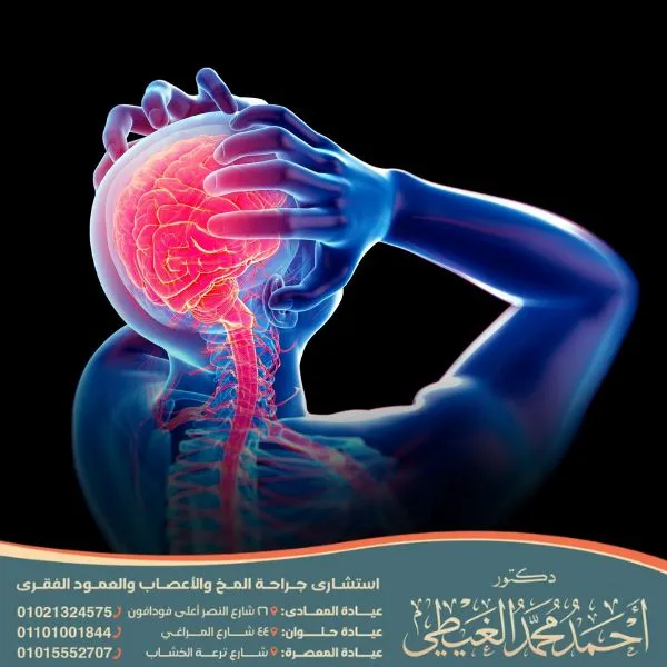 كم تستغرق عملية نزيف الدماغ