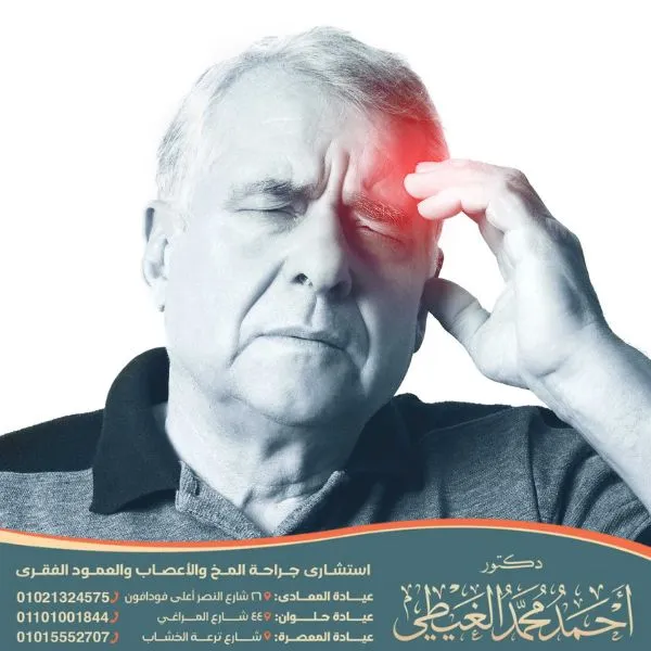 كم تستغرق عملية نزيف الدماغ