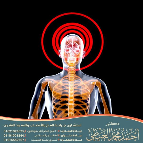 كيف يموت مريض الشريان السباتي