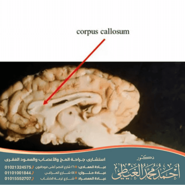 ما وظيفة الجسم الثفني