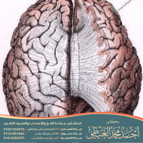 متى يكتمل نمو الجسم الثفني