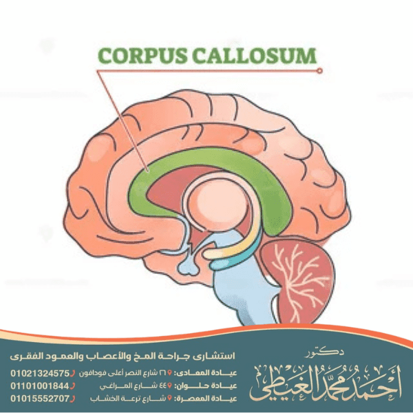 هل ضمور الجسم الثفني يجعل الطفل ينام دائما