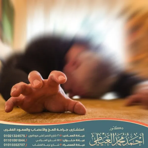 هل مرض الصرع وراثي ام لا