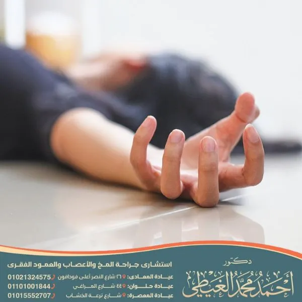 هل مرض الصرع وراثي ام لا