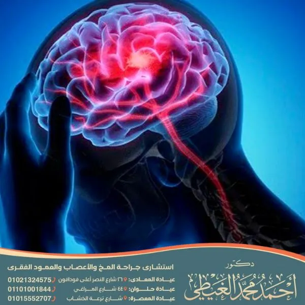 هل مرض الصرع وراثي ام لا