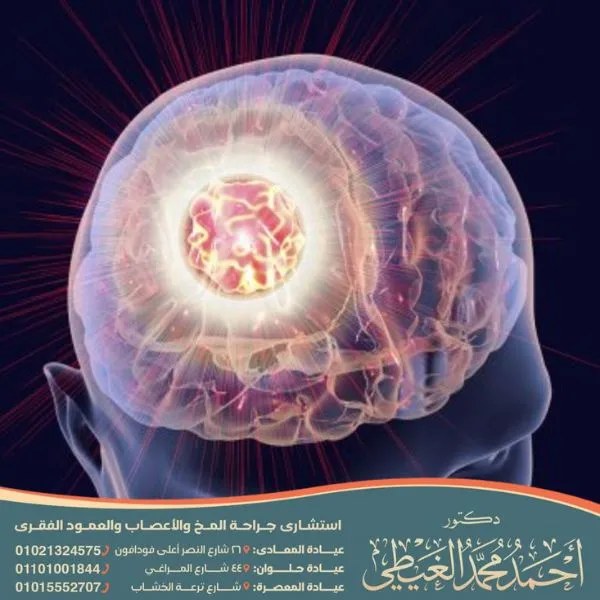 هل يشفي مريض سرطان الدماغ