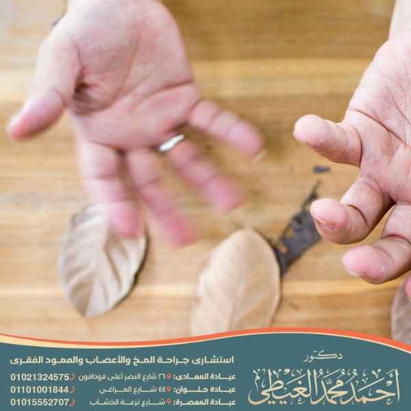 الجديد في علاج مرض الباركنسون