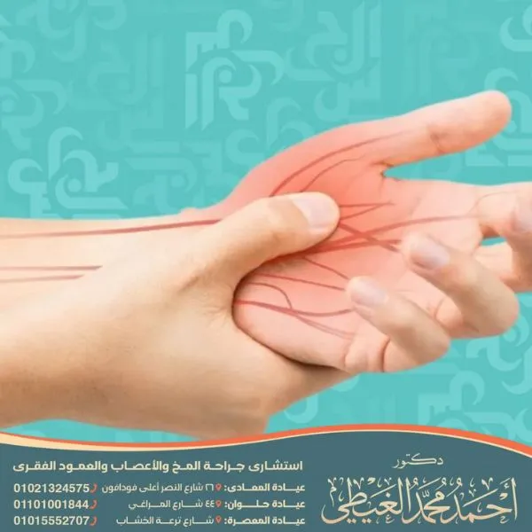 أعراض اختناق عصب اليد اليمنى