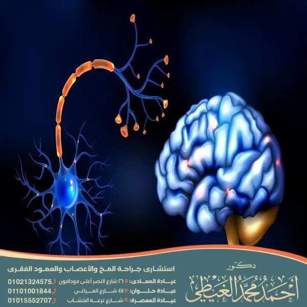 بديل عملية تسليك العصب