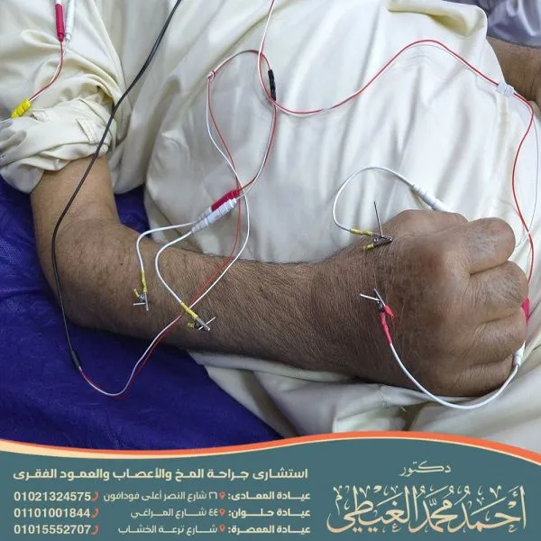 بديل عملية تسليك العصب