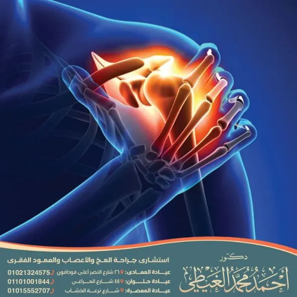 أفضل علاج لالتهاب الأعصاب والمفاصل