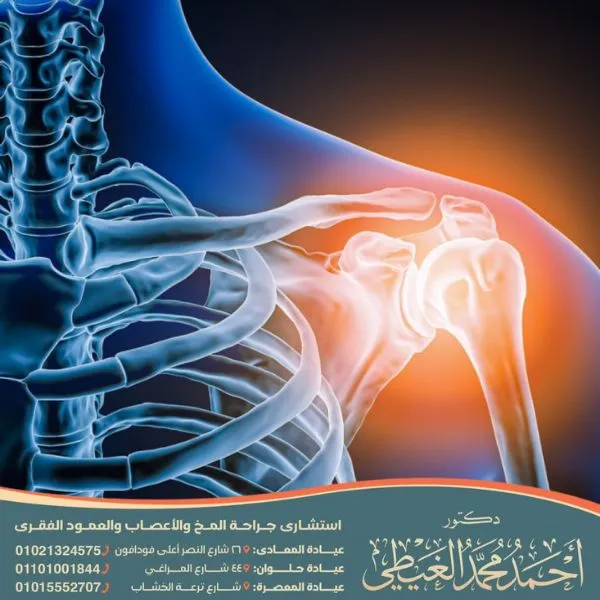 أفضل علاج لالتهاب الأعصاب والمفاصل