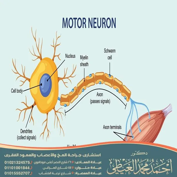 عملية العصب الخامس