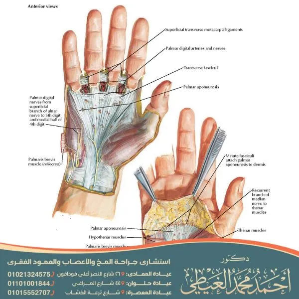 عملية العصب الزندي