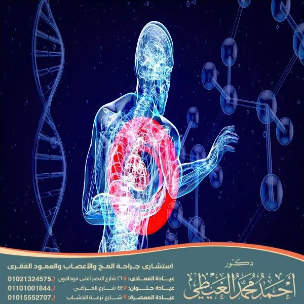 عملية العصب السمبثاوي