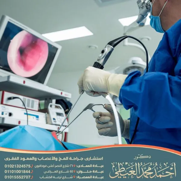 عملية القسطرة الدماغية