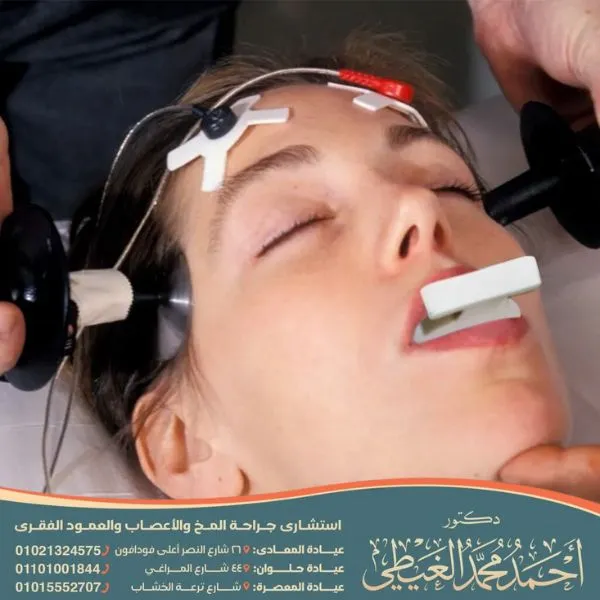 عملية القسطرة الدماغية