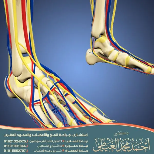 عملية تحرير العصب في القدم