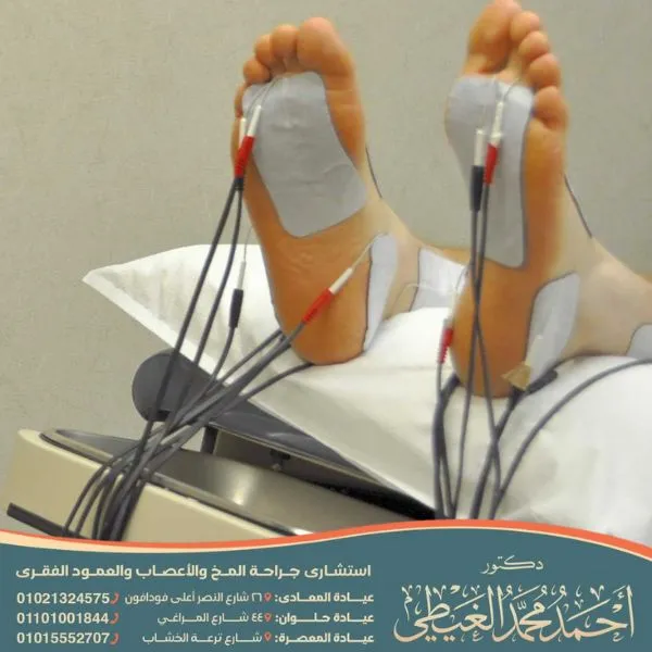 عملية تحرير العصب في القدم