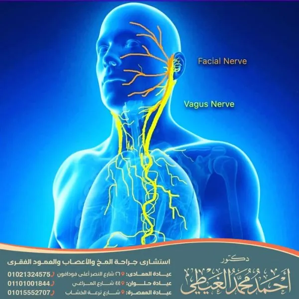 عملية توسيع القناة العصبية