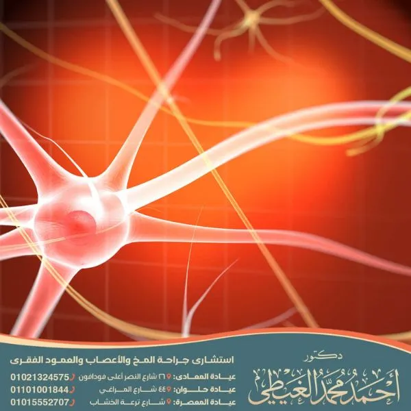 عملية توسيع القناة العصبية