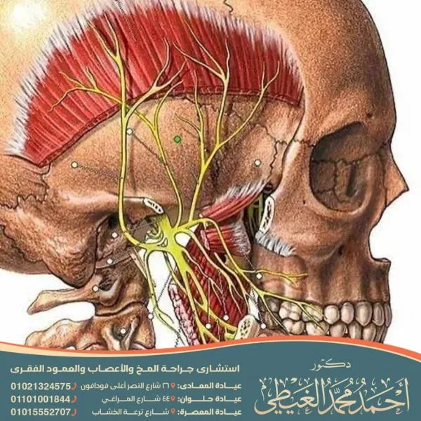 عملية توسيع القناة العصبية
