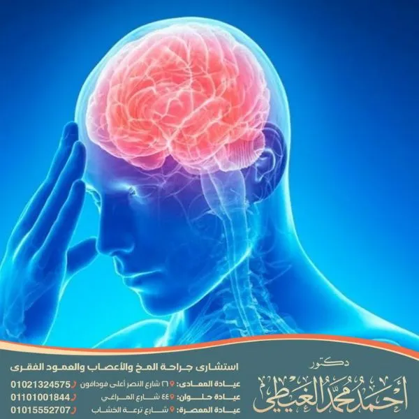 مدة غيبوبة نزيف المخ