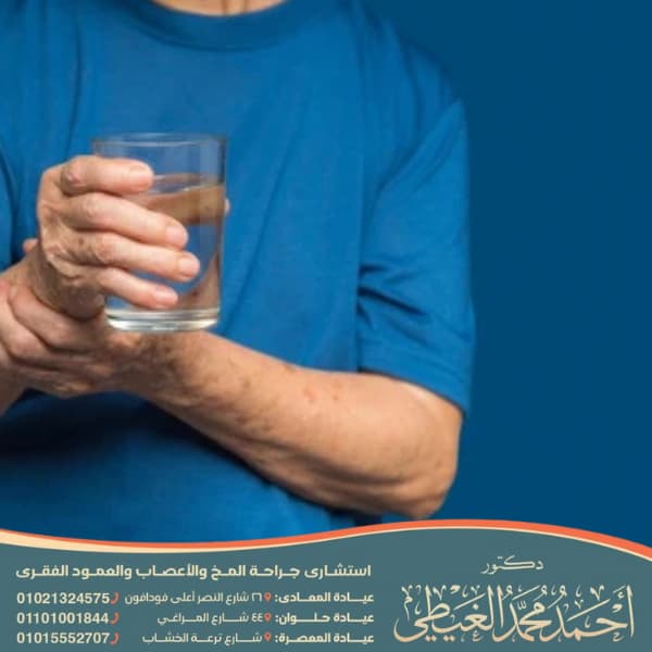 الشلل الرعاش أسبابه وعلاجه