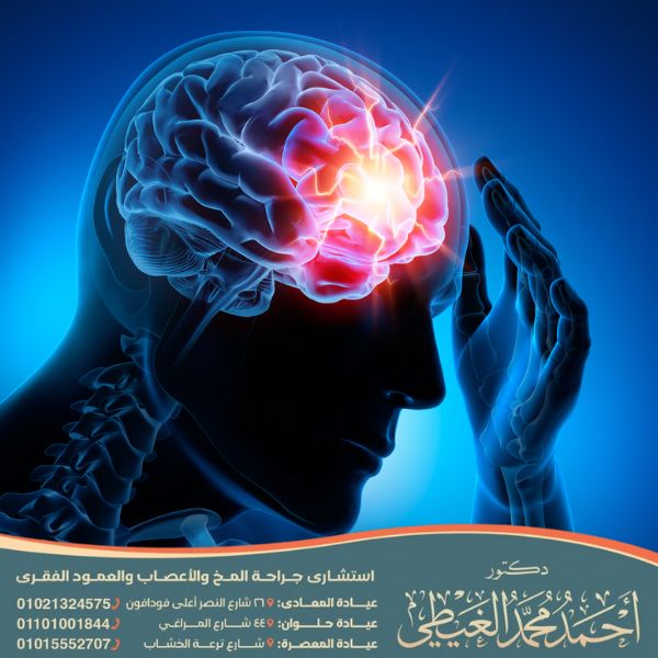 أضرار توسع بطينات الدماغ