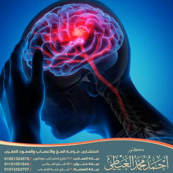 أضرار توسع بطينات الدماغ