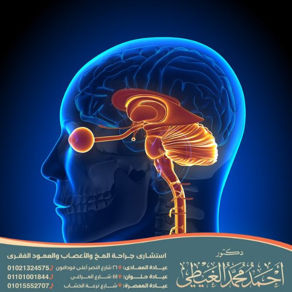 أضرار توسع بطينات الدماغ